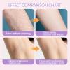 cdpdmai Body Hair Trimmer Women's Bikini Trimmer, Beard Eyebrow Shaver, Intimate Body Trimmer, Body Trimmer for Ears, Beard, Intimate Areas, Legs, Face(Color:Pink) view 4