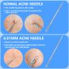 AskBed 5PCS Blackhead Remover Comedone Extractor Kit view 2