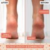 Argaviva Foot Care Bundle  Natural Terracotta Pumice Stone & Nourishing Argan Oil Foot Cream for Smooth, Hydrated, Callus-Free Feet view 2