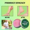 Senzion Miracle Balm, Miracle Balm for Swollen Legs, Natural Ingredients, Relaxed and Comfortable, Soothing Joint Cream for Back, Hands, Feet and Body, Improves Joint Comfort (2) view 4