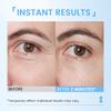 RONKIE Instant Eye Lift Cream: Reduces Eye Bags Wrinkles Puffy Eyes Dark Circles Crows Feet in Minutes for Mature Skin of Middle-aged Women 1 Fl Oz (Light) view 2