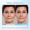 RONKIE Instant Eye Lift Cream: Reduces Eye Bags Wrinkles Puffy Eyes Dark Circles Crows Feet in Minutes for Mature Skin of Middle-aged Women 1 Fl Oz (Light) view 3