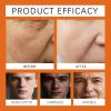 Bee Venom Skin RestorationCream, Bee Venom Skin Treatment Cream, Repair skin and Firming, Effective In Reducing Blemishes, Comprehensive MoisturizerCream for All skinTypes (3) view 4
