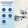 Arnica Bruise Cream Extra Strength,Fast-Acting for Bruising & Swelling on Thin Skin - Advanced Formula with Arnica Montana Vitamin K C & E - Soothing Hydrating for Face and Body view 3