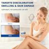 Arnica Bruise Cream Extra Strength,Fast-Acting for Bruising & Swelling on Thin Skin - Advanced Formula with Arnica Montana Vitamin K C & E - Soothing Hydrating for Face and Body view 4
