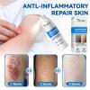 ATTDX Magnesium Herbal Soothing Spray - Relieves Itchy & Irritated Skin, Calming Rash for Face and Body, Natural Cooling Mist for Sensitive Skin (3) view 2