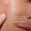 bellaCamo Pimple Patches Hydrocolloid Pimple Patches for Face and Skin, Invisible Acne Patches for Pimples, Whiteheads & Blemishes- Ultra-Thin Spot Covers for Day or Overnight Use- 108 Ct. view 2