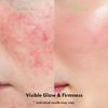 NUKIT PORE RESET PEELING AMPOULE view 4