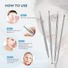 Blackhead Remover Pimples Popper Acne Tool kit with Diagonal Tweezers for Guys and Ladies view 2