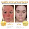 BeeRx Bee Venom Skin Restoration Cream, 2025 New Bee Venom Skin Treatment Cream - Effective In Reducing Blemishes, Natural bee venom Moisturizer for All Skin Types (1) view 4