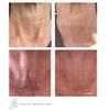 Smoothology NECK+ Regenerative Cream, Collagen Boosting Neck Cream, Firms,Tightens, Lifts, with Peptides & Growth Factor Complex, Gentle on Skin,Clinically Tested, 1.7 fl oz (Full-Size) view 4