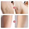 Ezme - Ezme Razor, The Trimmie 2.0 by Ezme, Ezme Bikini Trimmer, Ezme Shaver, 2 in 1 Ezme Hair Removal, Waterproof Wet & Dry Use for Bikini Area (Blue)(Purple) view 2