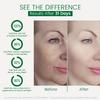 AOAO Kojic Acid Moisturizer, Face Lifting Cream for Women, Firming & Nourishes Skin, Niacinamide for Hydrates, Smoothing Rough Face Skin, Deep Moisturizing & Improve Elasticity, 130g/4.586 oz view 4