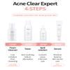 Acne Clear Expert System  4-Step Skincare Set for Blemish-Prone Skin (Foam Cleanser, Powder Toner, Spot Solution, Serum) view 2
