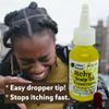 Urban ReLeaf Itchy Scalp Oil Treatment ! Braids, Wigs, Weaves, Tight Hairstyles & Itchy Skin Relief, Shaved Bald Head, Quickly Soothe Irritation, Natural Herbal Remedy, Made Fresh in USA! (Pack of 2) view 2