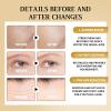 2pcs Snail Collagen Face Cream,Collagen Hydrating Anti-Wrinkle and Rejuvenating Cream,Anti-Wrinkle and Rejuvenating Cream for Women view 4