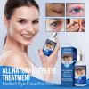 Stye Eye Treatment, Eye Stye Relief Serum for Humans, Stye Cure, Non-Irritating Formula, Target Chalazions & Blepharitis (1 Fl. OZ) view 2