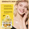Bee Venom Cream, Natural Bee Venom Skin Treatment Cream-for Removing and Repair, Effective In Reducing Skin Blemishes, Gentle and Non-irritating view 3