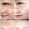 2pcs Snail Collagen Face Cream, Snail Hydrating Anti-Wrinkle and Rejuvenating Cream, Kormesi Snails Repair Creams, Firming & Hydrating Moisturizer Creams for All Skin Types view 2