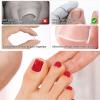 (50+1) Pcs Ingrown Toenail Treatment Corrector Set, Professional Pain-Free Ingrowns Toenails Removal Kit with Lifter, Toenail Strip for Men Women, Easy Fixed Ingrowns Toenails Tool view 3
