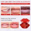 Cherry Lip Mask  Hydrating, Moisturizing, Lip Plumper  Reduces Lip Lines and Brightens Lip Color  Collagen Infused  60g / 20 Pairs view 4