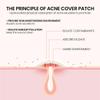 VelvetPore Skin Care Hydrocolloid Pimple Cover Patches  Invisible Spot Cover, Waterproof Oil-Absorbing Stickers, Strong Adhesion, 72 Count (12mm & 10mm Sizes) view 3