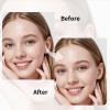 VelvetPore Skin Care Hydrocolloid Pimple Cover Patches  Invisible Spot Cover, Waterproof Oil-Absorbing Stickers, Strong Adhesion, 72 Count (12mm & 10mm Sizes) view 4