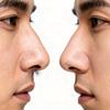 2-in-1 Nasal Hair Cutter2025 Upgraded Manual 360 Rotating Nostril Hair Removal Tool Double Sided Nose Hair BladePortable Nose Hair Trimmer for Women Men Travel Essentials (3 Set of 15 Pieces) view 4