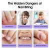 GELLEN Nail Biting Prevention for Kids & Adults, Bitter Taste, 15ml view 4