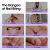 GELLEN Nail Biting Prevention for Kids & Adults, Roll-On, Bitter Taste view 3