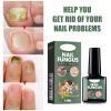 Nail Repair view 2