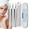 Blackhead Remover - Nose Tool, Precision Extractor Kit, 7X Tweezers, Durable Stainless Care Accessory, Effective Zit Removing Instrument | Facial Cleaning Tool for Forehead, Chin, Cheeks, Skincare view 1