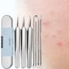 Blackhead Remover - Nose Tool, Precision Extractor Kit, 7X Tweezers, Durable Stainless Care Accessory, Effective Zit Removing Instrument | Facial Cleaning Tool for Forehead, Chin, Cheeks, Skincare view 3