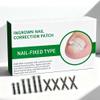 10-Piece Pack Titanium Alloy Ingrown Toenail Corrector,Curved Toenail Repair Patch,Memory Metal Ingrown Toenail Physical Correction Tool,Ingrown Toenail Removal Tool Set,Nail Aesthetic Shaping Tools. view 1