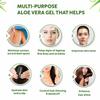 MM Non-Toxic Aloe Vera Gel for Acne, Scars, Glowing & Radiant Skin Treatment-(175ml) view 4