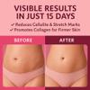 ADEUS Pink Rose Intensive Cream  Firming Anti-Cellulite & Stretch Mark Body Rosa Crema with Asiatica & Seaweed Extract  Moisturizing & Smoothing Skincare  300 g (300g, Pink Rose) view 4