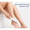 Bestac Hard Skin & Callus Remover Foot File - Durable Dead Skin Scrubber, Hygienic Pedicure Tool, Long-Lasting Foot Buffer to Get Soft Smooth Feet view 4