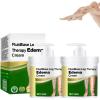 Balm for Swollen Legs  Leg Therapy Edema Cream for Fluid Ease & Lymphatic Drainage, Edema Relief for Legs and Feet, Swell Care Massage Cream(2pcs) view 1
