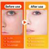 Peel Shot Keratin Care Kojic Acid Turmeric Spray, Turmeric Exfoliating Peeling Spray, Peel Shot Turmeric Spray for Face and Body, Exfoliate and Shine, Suitable for All Skin Types view 3