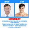 Kenashii Ear & Nose Waxing Kit, Wax Warmer Set, 100g Wax, 24 Professional Applicators, No Microwave Required, Effective Nose and Ear Hair Removal For Men and Women, 12 Balm Wipes, Storage Bag view 2