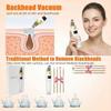 2026 Pore Vacuum, USB Rechargeable Blackhead Remover Vacuum,3 Levels Adjustable Pore Vacuum Blackhead Remover, with 5 Suction Power,6 Probes,Face Vacuum Pore Cleanser for Women & Men-Gold view 3