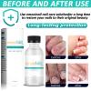 Emoninail Toenail  Treatment Extra Strength |  Nail Solution with Tea Tree Oil - Best Toenail Care Solution | Nail Treatment for Weak and Damaged Nails | 1.06 oz view 3