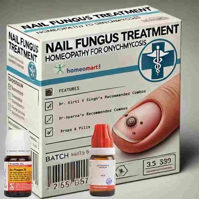 MycoNail Recovery Kit  Internal & Topical Homeopathy Treatment for Thick, Brittle, or Discolored Nails