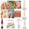 MycoNail Recovery Kit  Internal & Topical Homeopathy Treatment for Thick, Brittle, or Discolored Nails view 2