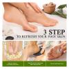 2 PCS Callus Remover for Feet and Hands - Hard Skin Scrubber Pumice Tool for Smooth Heels and Palms(Black White) view 4