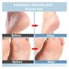 1PCS Foot File Callus Remover - Shower Foot Scrubber for Dead Skin & Soft Feet Pedicure Tool(Blue) view 3
