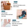1PCS Foot File Callus Remover - Shower Foot Scrubber for Dead Skin & Soft Feet Pedicure Tool(Blue) view 4