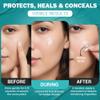 Mubo Care Pimple Patch Hydrocolloid Acne Dots for Face, Invisible and Waterproof Blemish Spot Treatment Fast Healing Pimple Stickers for All Skin Types (36 Count (Pack of 1)) view 4