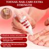 Toenail F-ungi Nail Care Extra Strength, Gentle Formula, Nail Triple Action Formula, Nail Repair Care with Tea Tree Oil, 2 Bottles and 2 Files view 4