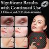 ANSIOVON Red Light Therapy Mask for Face view 3
